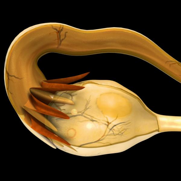 Por qué siento dolor en la pelvis - Dolor en la zona pélvica - mujeres 