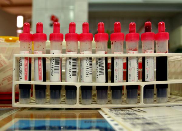 Cuál es la diferencia entre suero y plasma sanguíneo