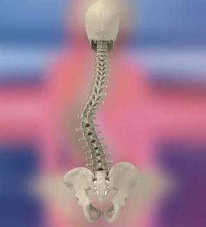 Los tipos de Escoliosis