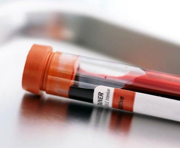 Por qué tengo la GGT Alta