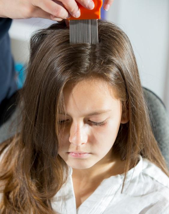 Cómo revisar la cabeza para saber si hay piojos