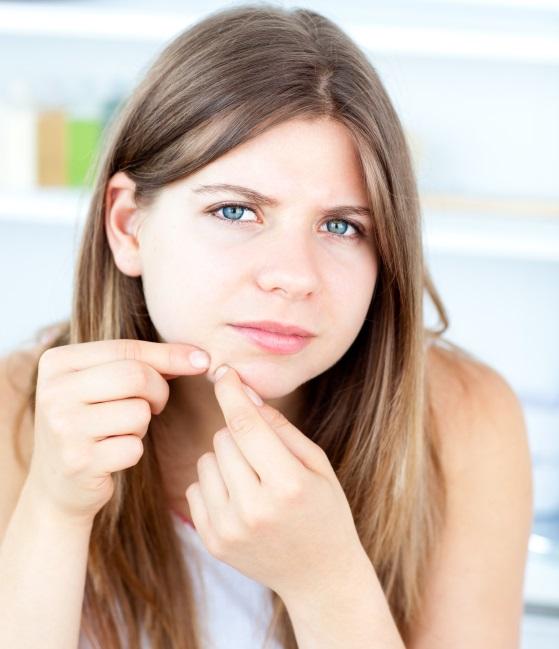 Aceites esenciales para el acné