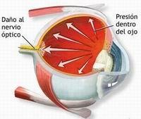 Por qué tengo los ojos rojos - Paso 6