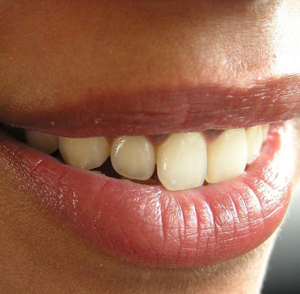 Cómo reparar las arrugas del labio