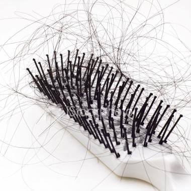 Cómo tratar la alopecia - Paso 1