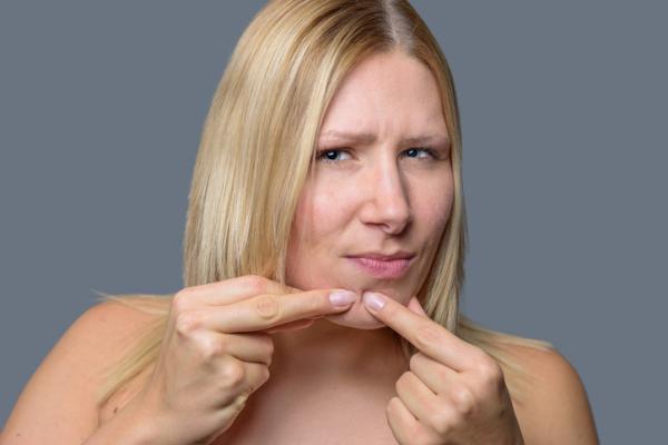 Cómo quitar los granos de la barbilla