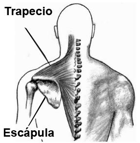 Contractura en el trapecio - tratamiento rápido y eficaz - Paso 1