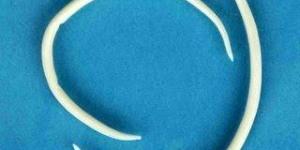 Cómo curar los oxiuros naturalmente