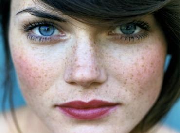 Cómo cuidar la piel con pecas