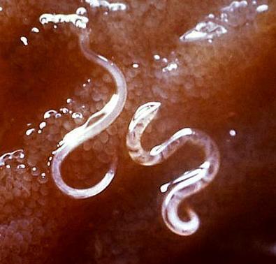 Cómo liberarse del anquilostoma