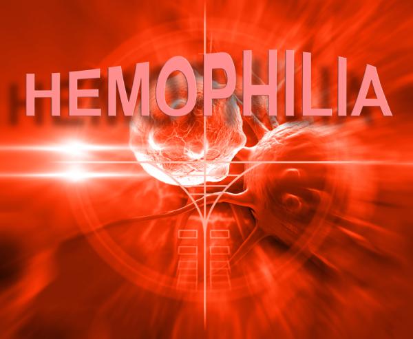 Cómo saber si tengo hemofilia