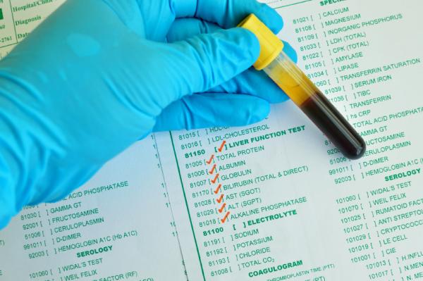 Enfermedades según el color de las heces - Heces amarillas