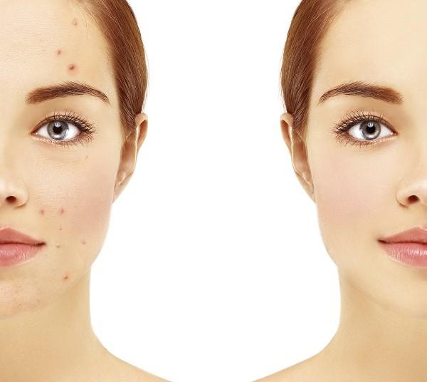 Por qué es malo dormir con maquillaje - Paso 2