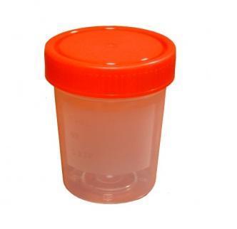 Cómo obtener orina mediante técnica de chorro medio en niños