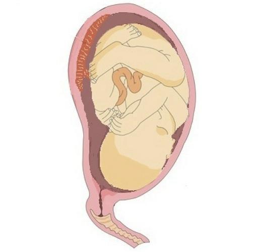 Cómo son las enfermedades de la placenta