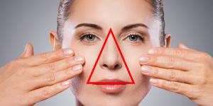 Qué es el triángulo de la muerte en la cara y por qué es peligroso explotar un grano