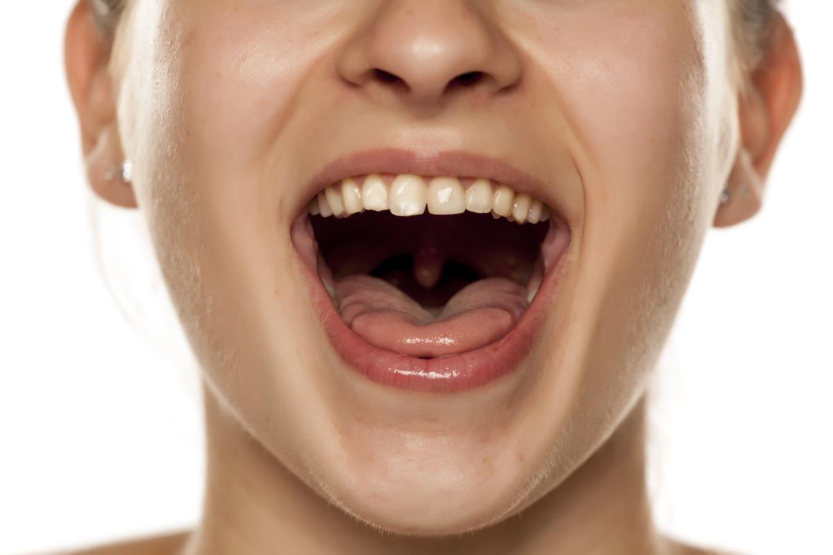 Cómo expulsar una piedra de la glándula salival