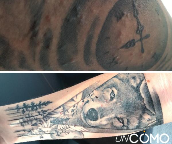 Por qué salen granitos en el tatuaje - Granitos en el tatuaje: causas