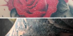 Por qué salen granitos en el tatuaje