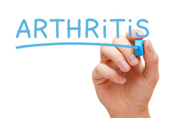 Causas del dolor de rodilla al subir y bajar escaleras - Dolor de rodilla por artritis