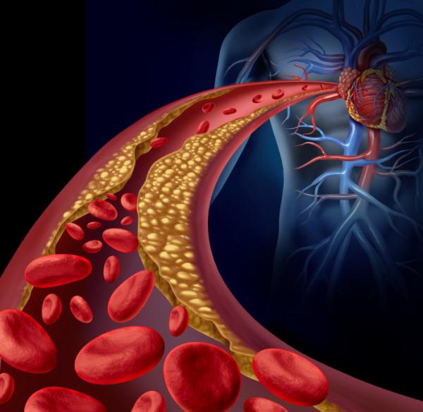 Cómo limpiar las arterias de forma natural