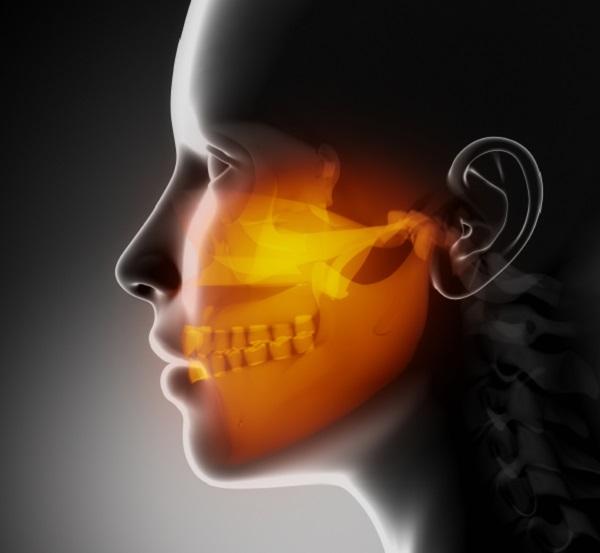 Por qué me duele la mandíbula - Paso 1