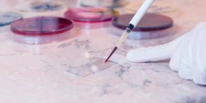 Cómo bajar la proteína C reactiva naturalmente