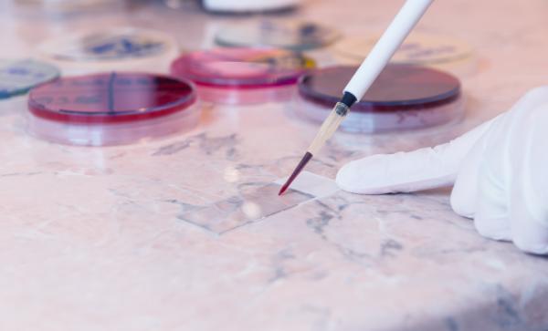 Cómo bajar la proteína C reactiva naturalmente