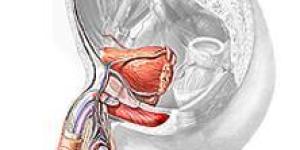 Cómo tratar la próstata grande