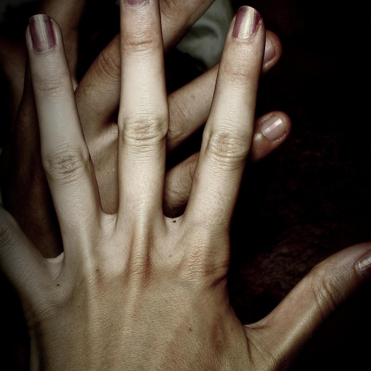 Cómo quitar nódulos artríticos de una mano