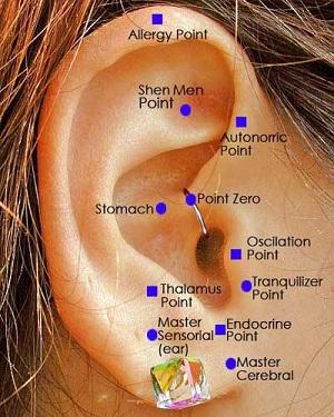Qué tener en cuenta al hacerme la auriculoterapia