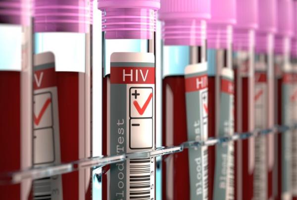 Qué enfermedades se transmiten por la sangre - Virus de inmunodeficiencia humana (VIH)