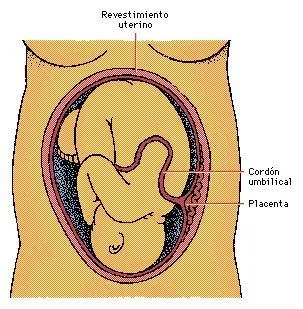 tipos de desprendimiento de placenta