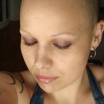 Cómo detectar la calvicie en la mujer