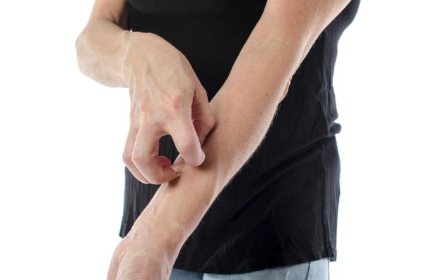 Por qué me pica una cicatriz - Por qué me pica una cicatriz - aquí la respuesta