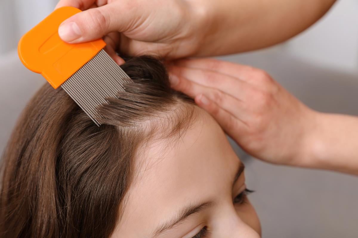 Cómo quitar los piojos en un día