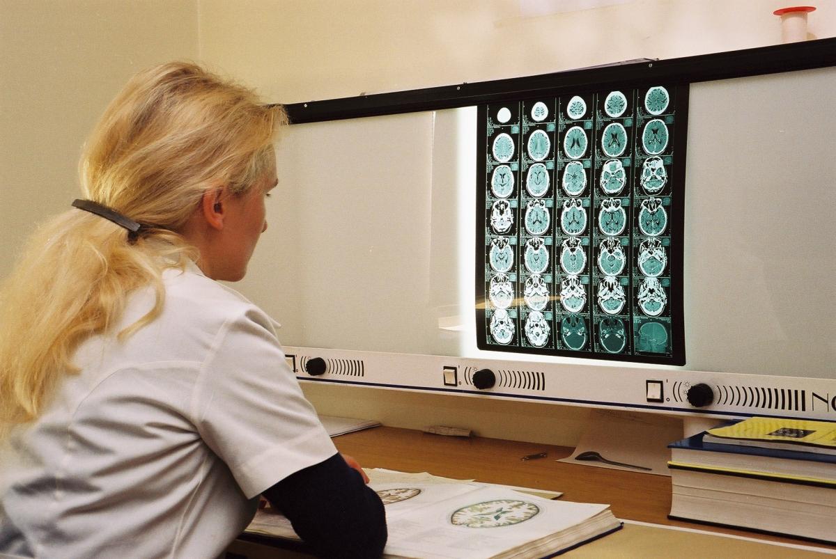 Qué es la quimioterapia adyuvante