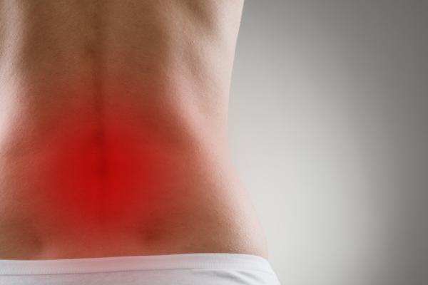 Cómo evitar un quiste pilonidal