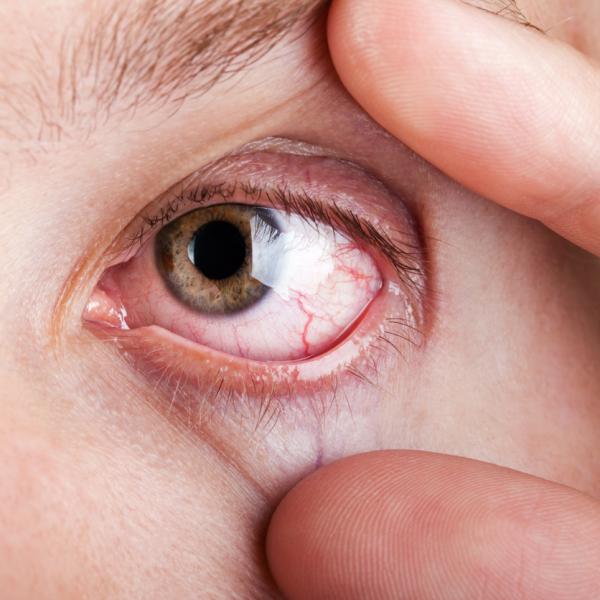 ojos blancos
