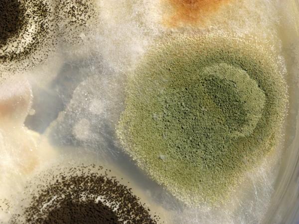 Cómo se contagia la balanitis - Causas de la balanitis: infecciones 