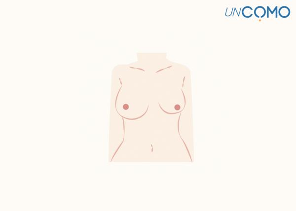 Tipos de senos - Senos asimétricos