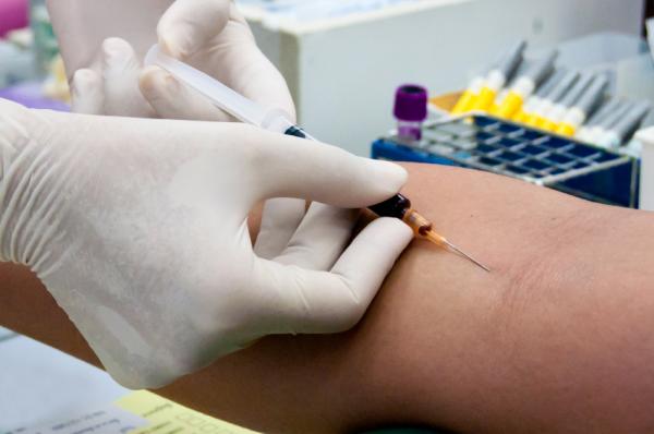 Cuántos litros de sangre tenemos - Cómo calcular los litros de sangre de nuestro cuerpo