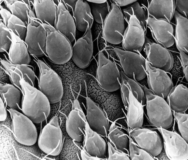 Cuáles son los síntomas de la giardiasis