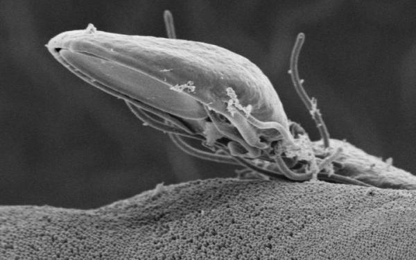 Cuáles son los síntomas de la giardiasis - Paso 4