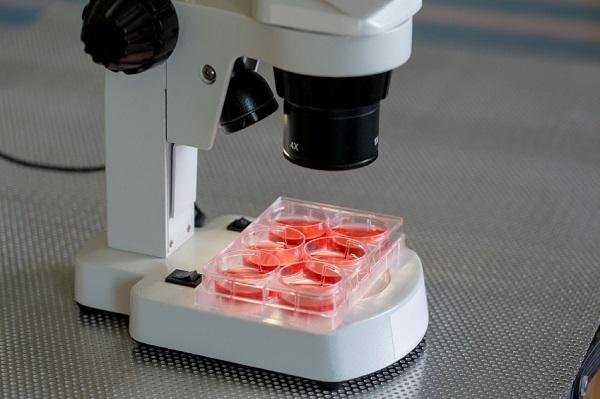 Síntomas de la anisocitosis