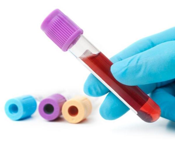 Qué significa gama glutamil transferasa