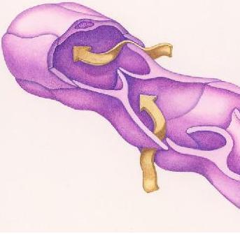 Cómo tratar la inflamación de los vasos linfáticos