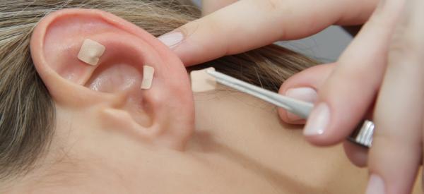 Cómo usar la auriculoterapia para la ansiedad - Paso 2